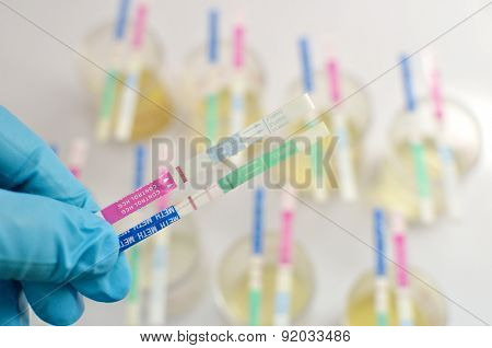 Urine testing