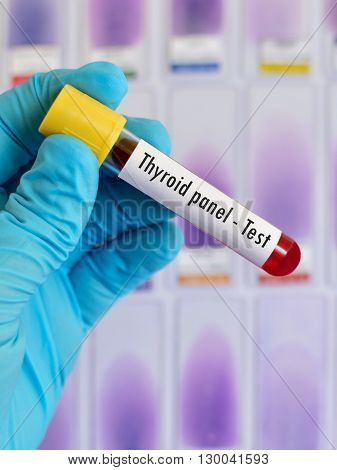 Blood sample for thyroid hormone panel test