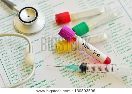 Test tube with blood sample for HIV test