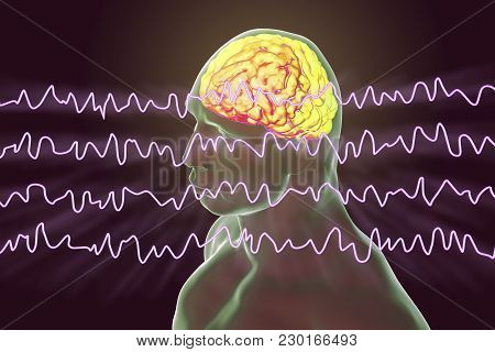 Eeg Electroencephalogram, Brain Wave In Awake State During Rest, 3d Illustration