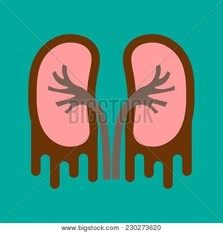 Kidney Disease Silhouette Icon. Stones In The Kidneys. Pyelonephritis. Urolithiasis Disease. Flat St