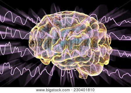 Eeg Electroencephalogram, Brain Wave During Sleeping, 3d Illustration