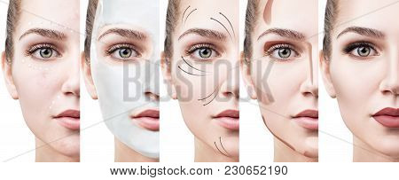 Beautiful Woman Step By Step Improves Her Skin Condition. Skin Care Concept.