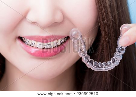 Woman Wear Beace And Take Invisible Braces For Your Health Concept
