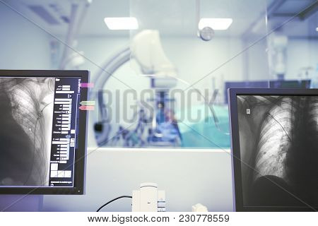 Medical Procedure Under The X-ray Control In Modern Hospital