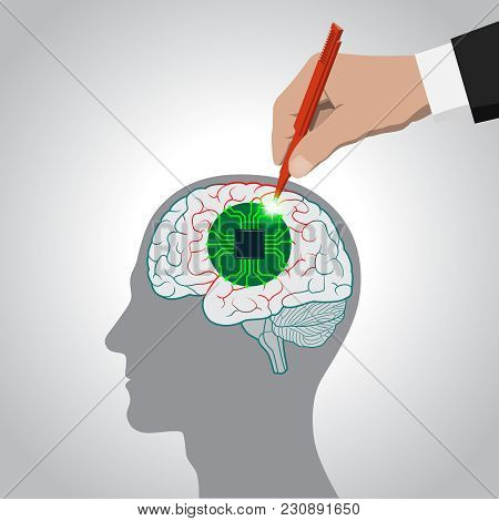Restoration Of Brain Functions, Prosthetics Of Affected Areas, Mind, Consciousness, Memory, Surgical