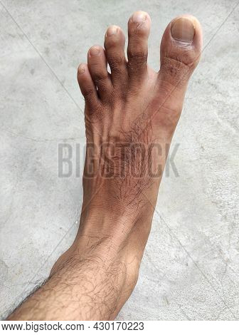 Man's Foot Hair Photos Background Blur And Selective Focus