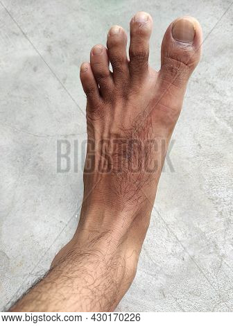 Man's Foot Hair Photos Background Blur And Selective Focus