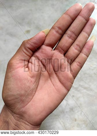 Hand Large Nail And Hand Fingers Photos  Selective Focus