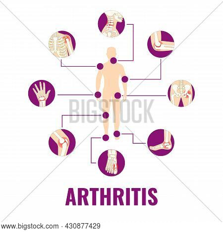 Vector Illustration On The Theme World Arthritis Day