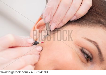 Woman On Electro-epilation Of The Face. Hardware Permanent Removal Of Unwanted Hair In The Salon