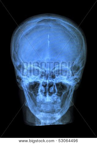 Human Skull Xray