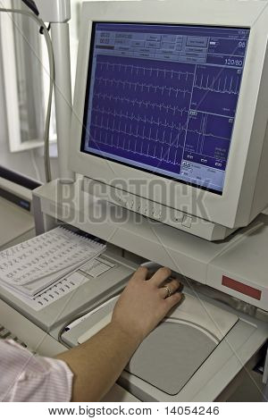 EKG Monitor