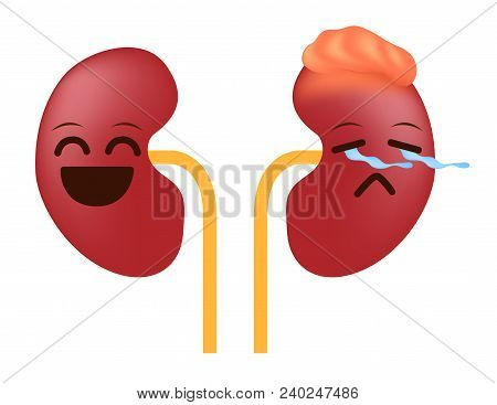 Kidney Cancer And Tumor Cartoon Vector On White Background