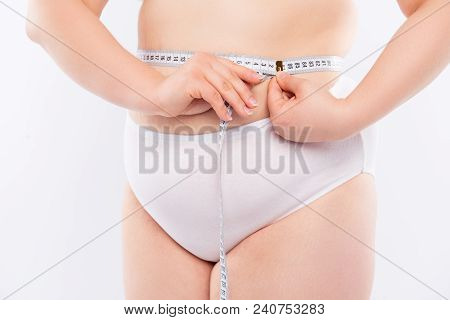 Weightloss Concept. Cropped Close Up Photo Of Fat Chubby Woman's Body With Stretch Marks, Pigments, 