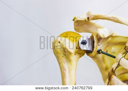 Articulated Humerus Clavicle And Scapula Bones Showing Human Right Shoulder Joint Anatomy In White B