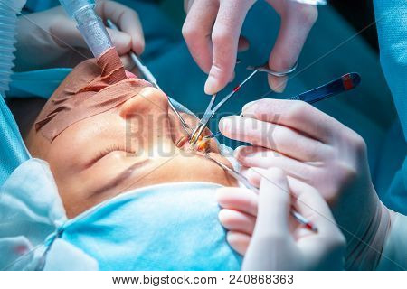 Plastic Surgery Of The Eyelid In Operating Room, Blepharoplasty