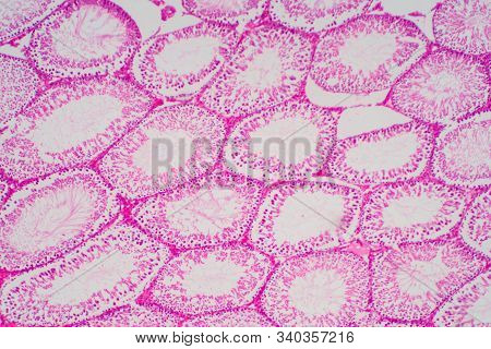 Human Sperm In The Testis Morphology Under Microscope. Micrograph Showing Spermatozoon For Pathology