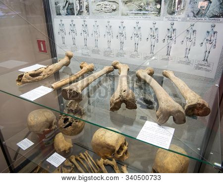 Azov, Russia - July 27, 2019: Parts Of The Skeleton Of Prehistoric People Found During Excavations. 