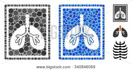 Lungs Fluorography Mosaic Of Small Circles In Various Sizes And Color Hues, Based On Lungs Fluorogra