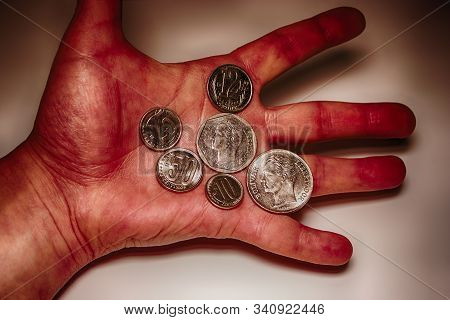 Coins Of Venezuela In The Male Palm. Dark Conceptual Background. Hyper Bolivar Inflation.
