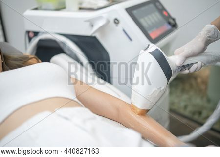 Epilation Laser, Hair Removal Or Epilation Hair On Woman Arm. Health And Beauty.