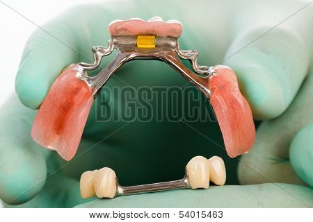Dolder And It's Place In Prosthesis