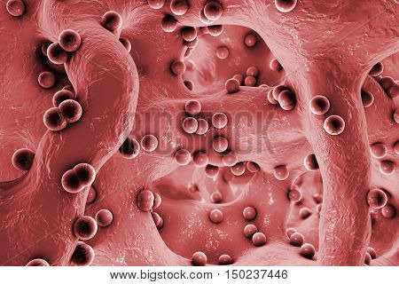 Spherical bacteria inside bone tissue. Osteomyelitis, 3D illustration