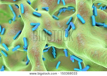Rod-shaped bacteria inside bone tissue. Osteomyelitis, 3D illustration
