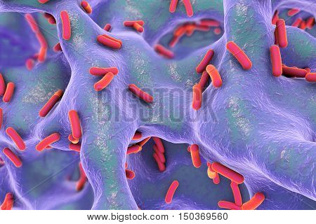 Rod-shaped bacteria inside bone tissue. Osteomyelitis, 3D illustration