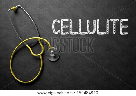Medical Concept: Cellulite -  Black Chalkboard with Hand Drawn Text and Yellow Stethoscope. Top View. Black Chalkboard with Cellulite - Medical Concept. 3D Rendering.