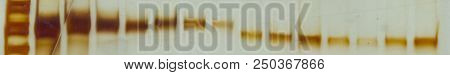 Detail Of A Polyacrylamide Gel Electrophoresis Where The Staining Of Proteins With Silver Nitrate In