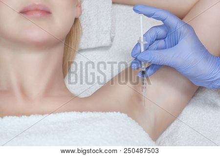The Doctor Makes Intramuscular Injections Of Botulinum Toxin In The Underarm Area Against Hyperhidro