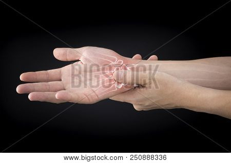 Wrist Bones Injury White Background Wrist Pain