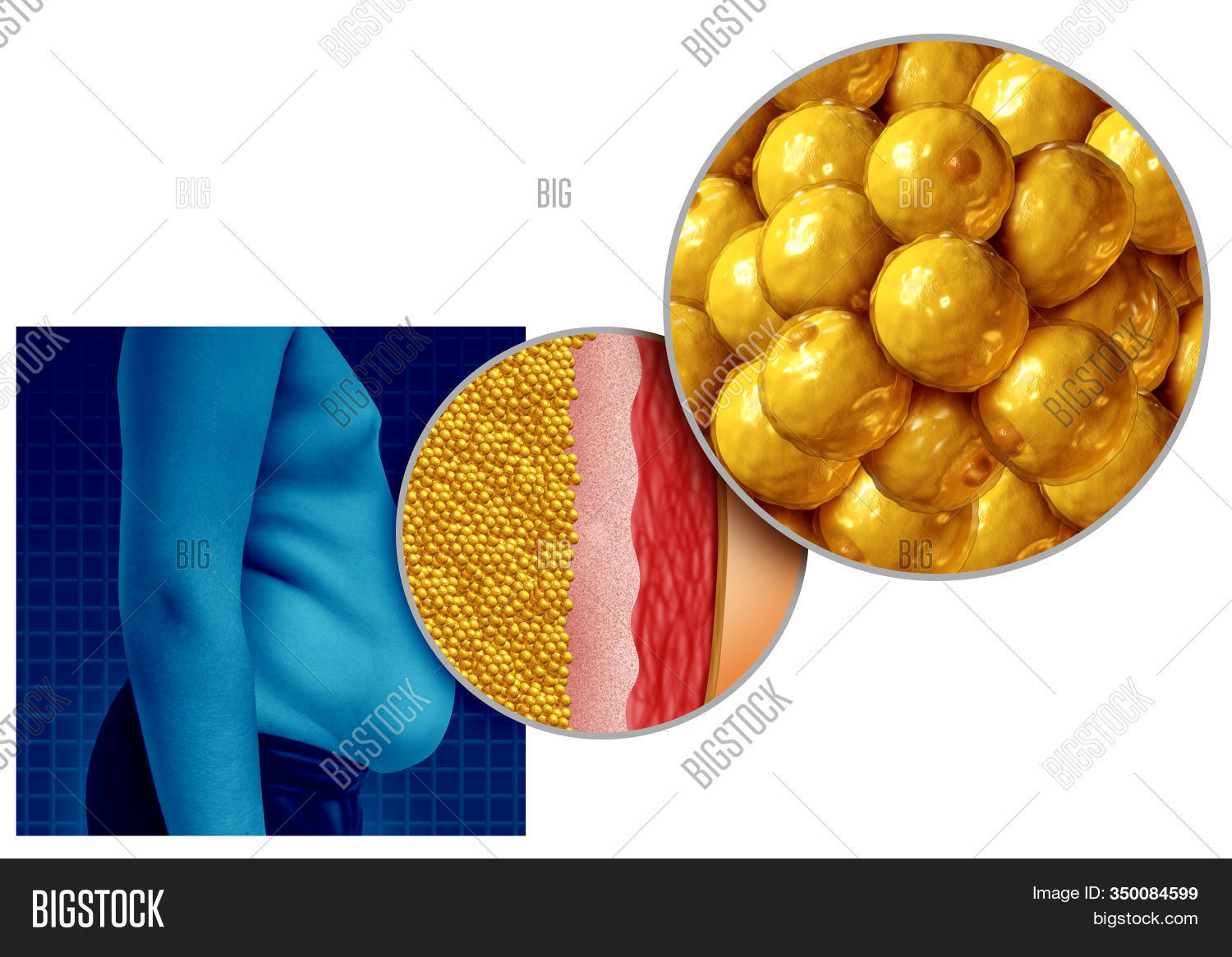 Belly Fat Anatomy Image & Photo (Free Trial) Bigstock