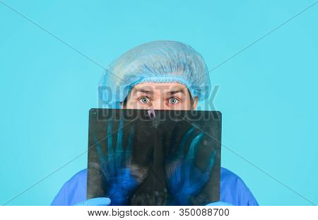 Doctor With X-ray. X-ray. Medicine. Bones. X-ray Bones. X Ray Photo Of Hand. Radiograph. Man With Xr