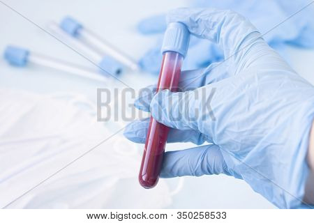 Doctor Or Nurse Holds A Test Tube To Send To The Laboratory For Blood Analysis. Hands Of A Laborator