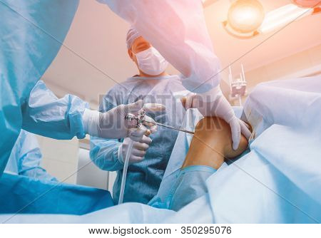 Arthroscope Surgery. Orthopedic Surgeons In Teamwork In The Operating Room