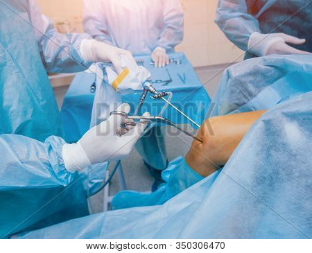 Arthroscope Surgery. Orthopedic Surgeons In Teamwork In The Operating Room