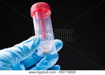 Doctor Hand With Plastic Container Sampling Of Feces