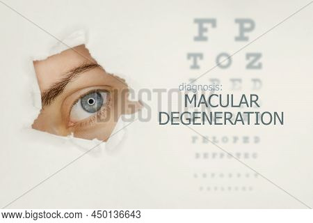 Macular Degeneration Disease Poster With Eye Test Chart And Blue Eye. Studio Grey Background