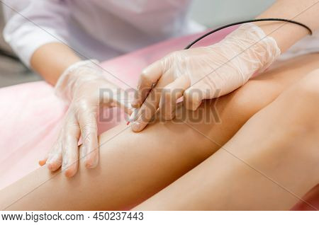 Dermatologist Doing Hair Removal Treatment On Patients Leg With Electrolysis. Depilation And Beauty 