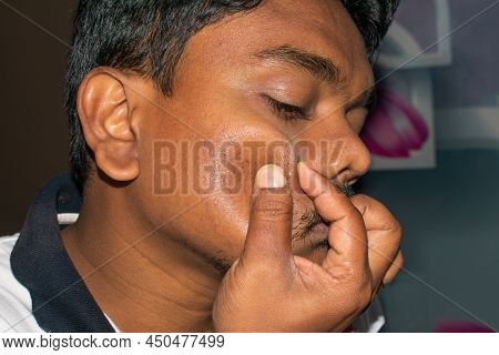Portrait Of Young Man With Acne Problem Squishing Pimples On Light Background