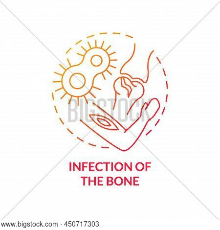 Infection Of Bone Red Gradient Concept Icon. Common Joint Condition Abstract Idea Thin Line Illustra