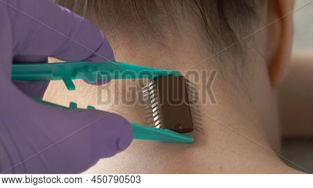 Implantation Of A Microchip Under Human Skin. Human Mind Control Using Computer Technology. Identify