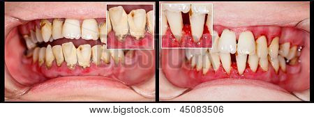 Before And After Treatment