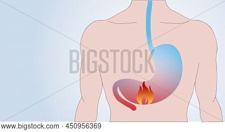 Medical Examination. Examination Of The Stomach, Intestines, Digestive Problems, Gastritis. Copy Spa