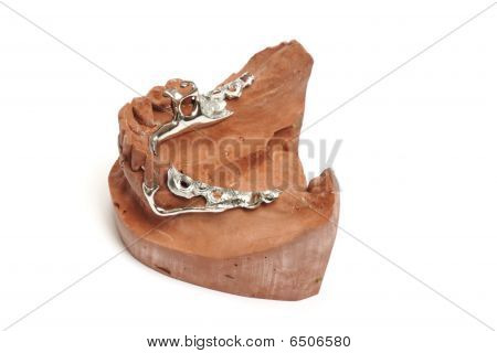 Dental Putz Formen, Zahnersatz