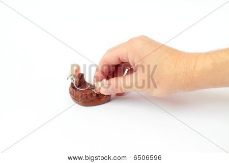 Befestigung des künstlichen Jaws Gips Modell