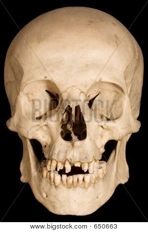인간 Braincase